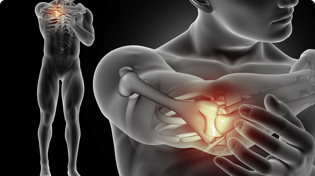 Person holding their knee in pain, with an X-ray overlay showing the knee joint.