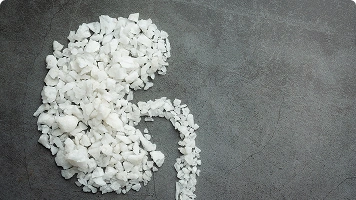 A detailed anatomical illustration of a kidney with visible kidney stones obstructing the urinary tract.